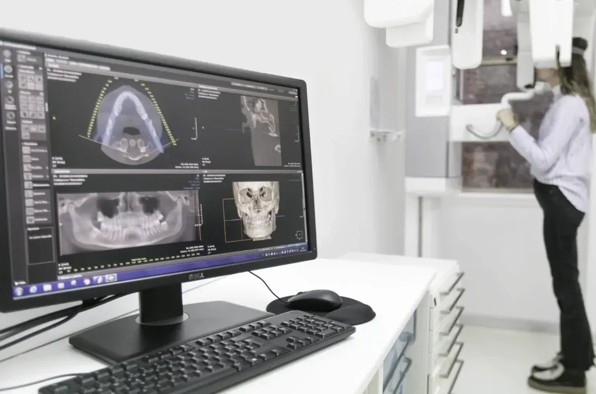 Dentiste Antony, technologies du cabinet des Drs Kaabar & Deschatres : chirurgie guidée